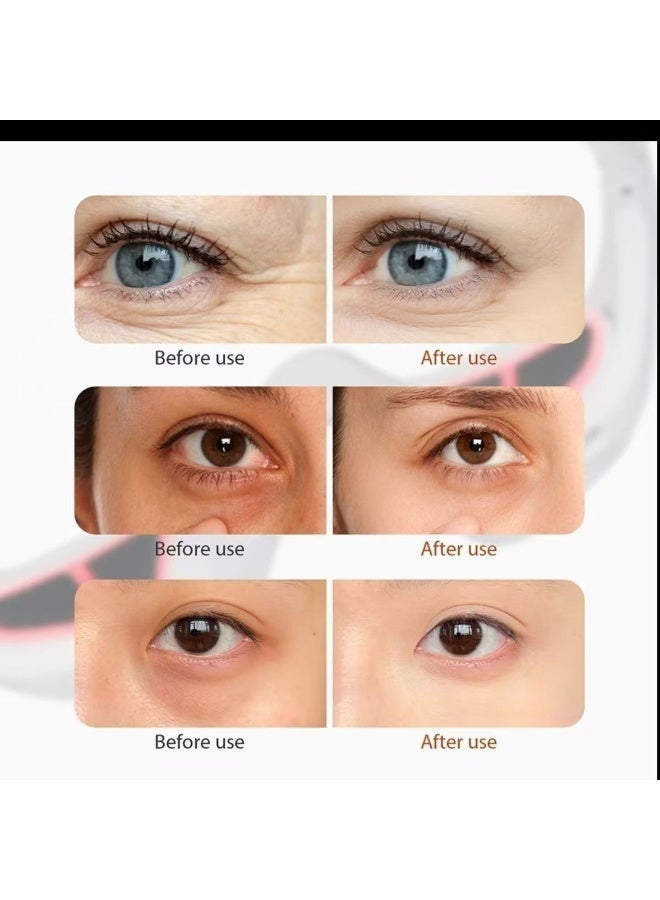 كيلو كيلو فولت جهاز إزالة تجاعيد العين، العناية بالعين، جهاز تدليك العين ثلاثي الأبعاد، واقي العين النبضي EMS، شد أكياس العين، تقليل الخطوط الدقيقة والهالات السوداء - Image 5